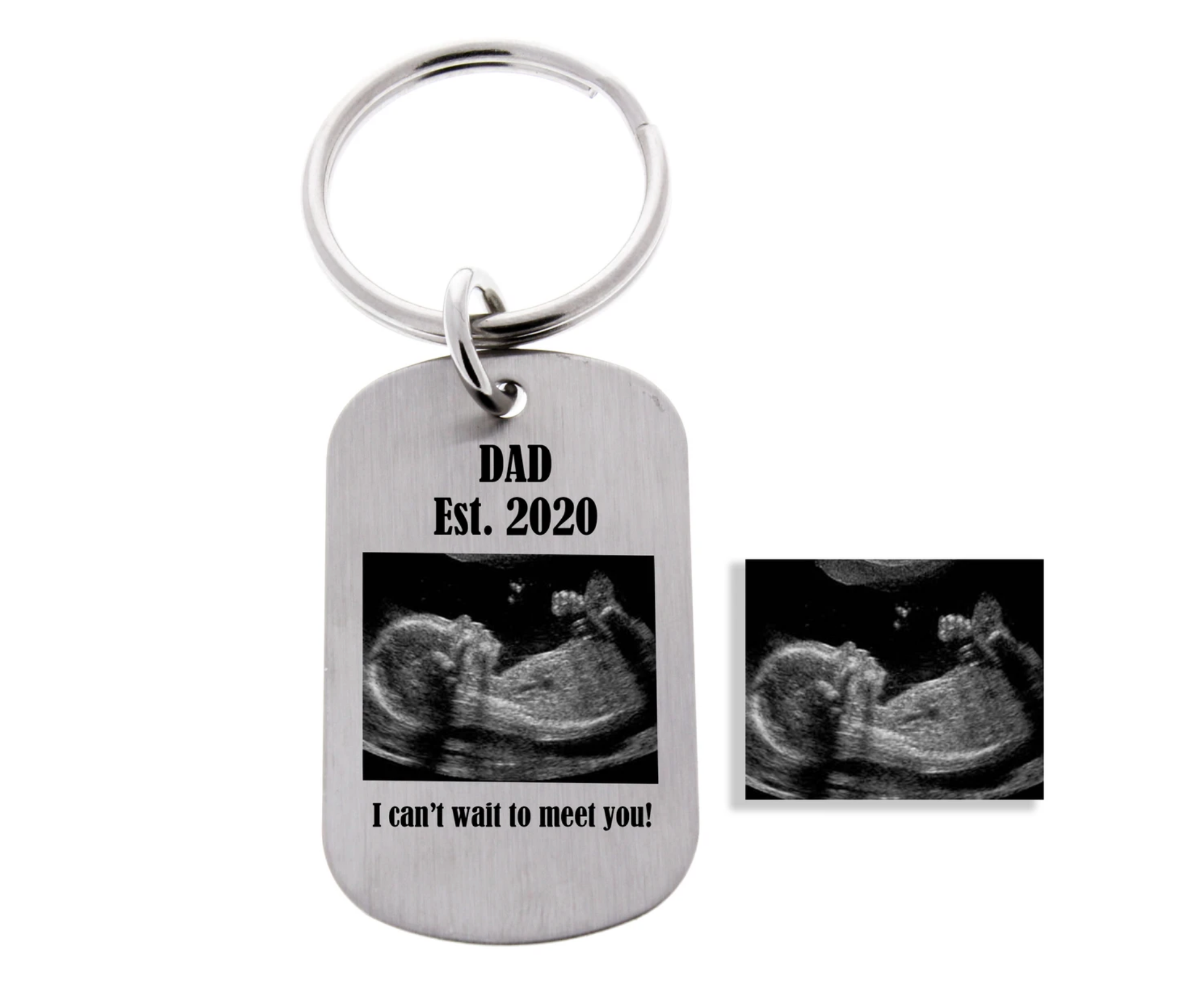 Ultrasound Keychain Sonogram Keychain Anomaly Creations Designs Inc